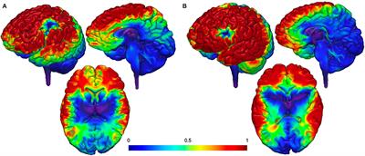 Targeting the Salience Network: A Mini-Review on a Novel Neuromodulation Approach for Treating Alcohol Use Disorder